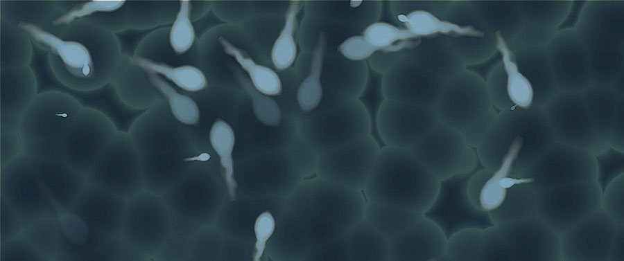 Microdeleciones en el Cromosoma Y –  AZF